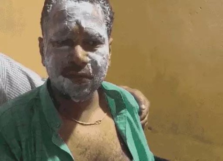 दौसा : अजब-गजब : प्रत्याशी ने अपनी कार को आग लगवाई, फिर फूट-फूटकर रोया, चुनाव में फायदे के लिए रची साजिश; पुलिस ने खोली पोल